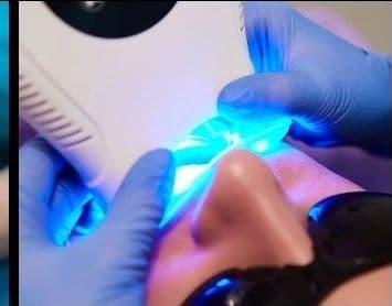 LED light during a whitening session